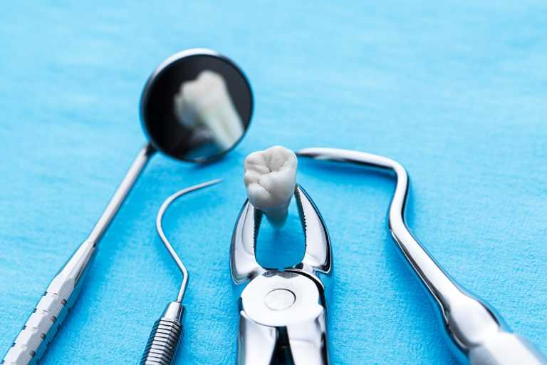 Wisdom Tooth Removal: When Should You Have It Done? | AgseLaw.com